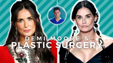 DEMI MOORE BEFORE AND AFTER: Beverly Hills Plastic .